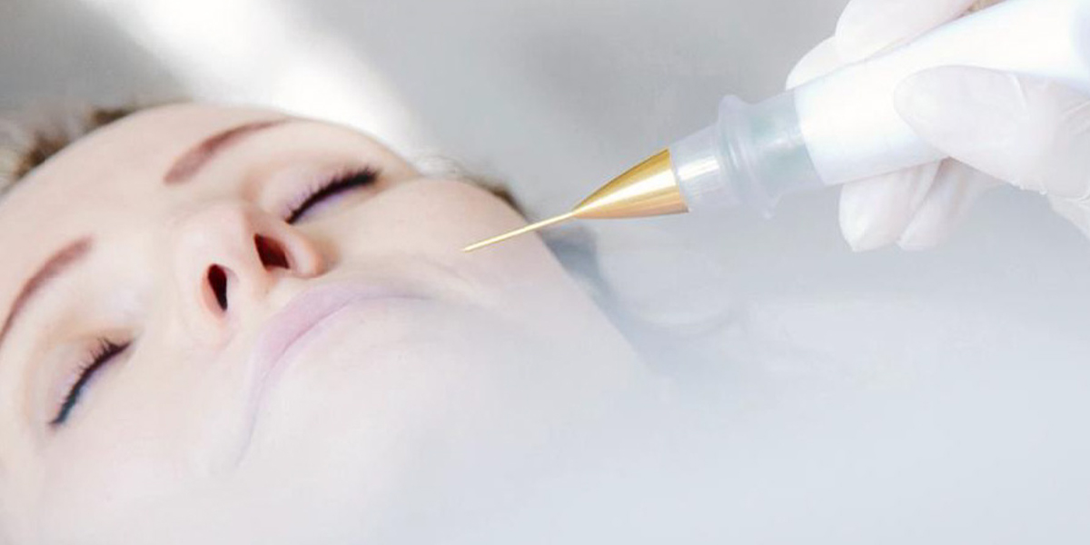 Jett Plasma Lift